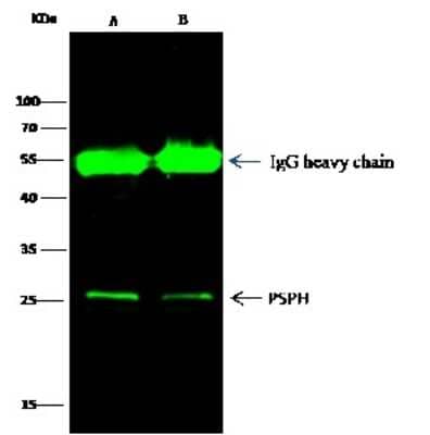 Western Blot: Phosphoserine phosphatase Antibody (001) [NBP2-90222]