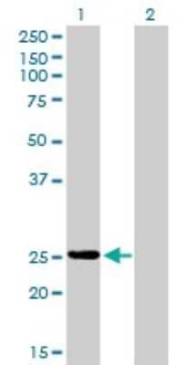 Western Blot: Phosphoserine phosphatase Antibody (2G9) [H00005723-M02]