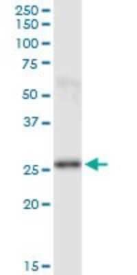 Western Blot: Phosphoserine phosphatase Antibody (3A5) [H00005723-M01]