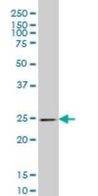 Western Blot: Phosphoserine phosphatase Antibody (3C1) [H00005723-M06]