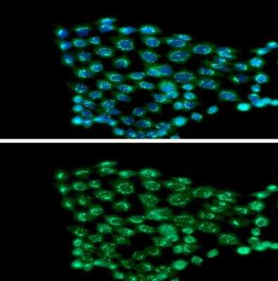Immunocytochemistry/ Immunofluorescence: Phosphoserine phosphatase Antibody (3G12) - BSA Free [NBP1-04297]