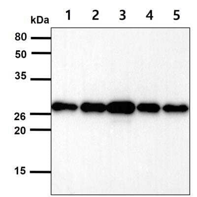 Western Blot: Phosphoserine phosphatase Antibody (3G12)BSA Free [NBP1-04297]