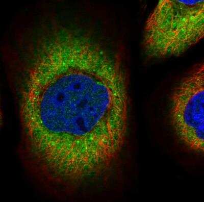 Immunocytochemistry/ Immunofluorescence: Phosphoserine phosphatase Antibody [NBP2-47625]