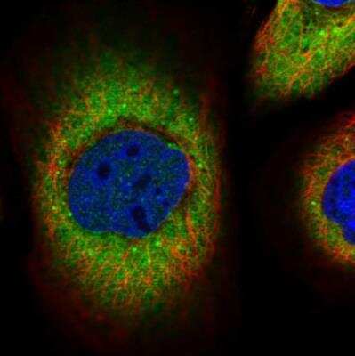 Immunocytochemistry/ Immunofluorescence: Phosphoserine phosphatase Antibody [NBP2-52738]