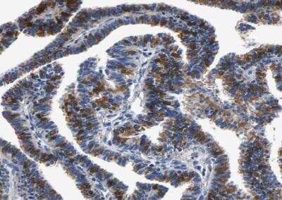 Immunohistochemistry-Paraffin: Phosphoserine phosphatase Antibody [NBP1-87203]