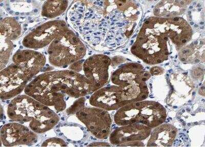 Immunohistochemistry-Paraffin: Phosphoserine phosphatase Antibody [NBP1-87203]