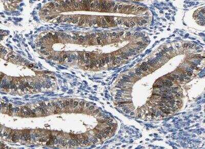Immunohistochemistry-Paraffin: Phosphoserine phosphatase Antibody [NBP1-87203]