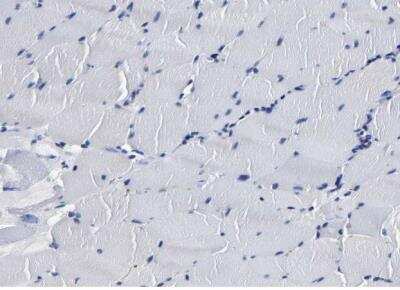 Immunohistochemistry-Paraffin: Phosphoserine phosphatase Antibody [NBP1-87203]