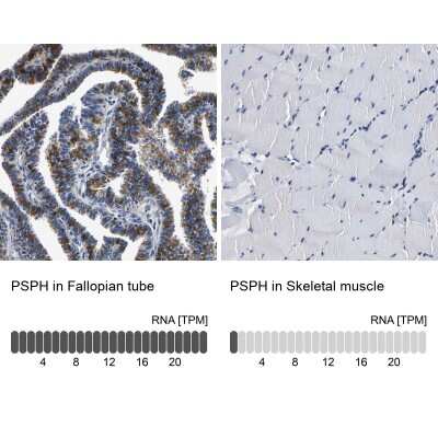 Immunohistochemistry-Paraffin: Phosphoserine phosphatase Antibody [NBP1-87203]