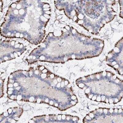 Immunohistochemistry-Paraffin: Phosphoserine phosphatase Antibody [NBP2-47625]