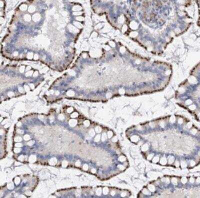 Immunohistochemistry-Paraffin: Phosphoserine phosphatase Antibody [NBP2-52738]