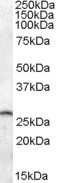 Western Blot: Phosphoserine phosphatase Antibody [NBP1-28916]