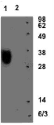 Western Blot: Phosphoserine phosphatase Antibody [NBP1-56848]