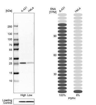 Western Blot: Phosphoserine phosphatase Antibody [NBP1-87203]