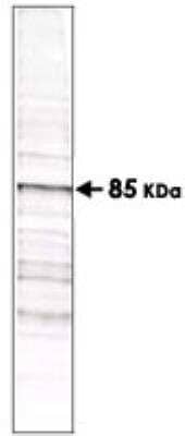 Western Blot: Phosphothreonine Antibody (18F6) [NB600-878]