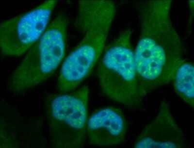 Immunocytochemistry/ Immunofluorescence: Phosphothreonine Antibody [NB110-96896]