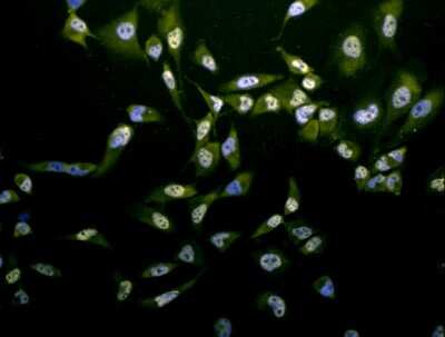 Immunocytochemistry/ Immunofluorescence: Phosphothreonine Antibody [NB110-96896]