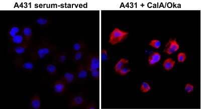 Immunocytochemistry/ Immunofluorescence: Phosphothreonine Antibody (RM102) [NBP2-77398]