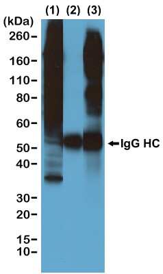 Immunoprecipitation: Phosphothreonine Antibody (RM102) [NBP2-77398]