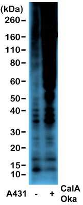 Western Blot: Phosphothreonine Antibody (RM102) [NBP2-77398]