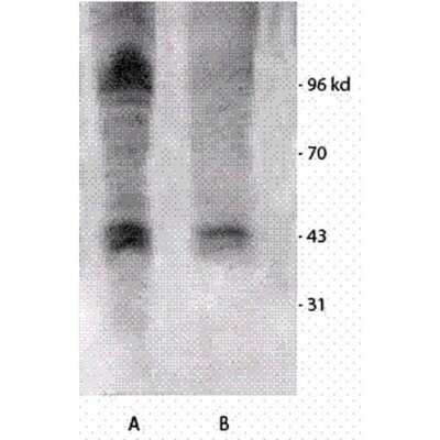 Western Blot: Phosphothreonine Antibody [NB110-96896]