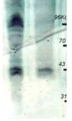 Western Blot: Phosphothreonine Antibody [NBP1-78035]