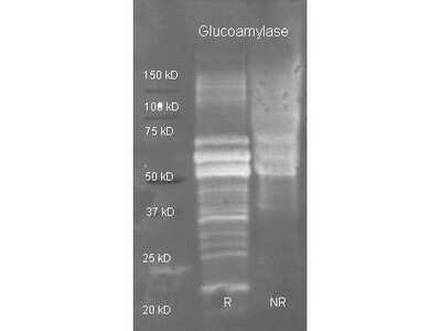 Western Blot: Phosphothreonine Antibody [NBP1-78035]