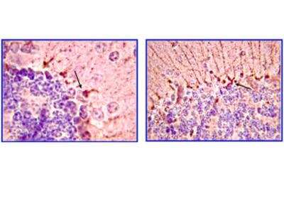 Immunohistochemistry: Piccolo Antibody (4G3.3) [NBP2-29749]