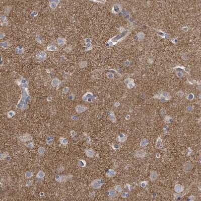 Immunohistochemistry-Paraffin: Piccolo Antibody [NBP1-90250]