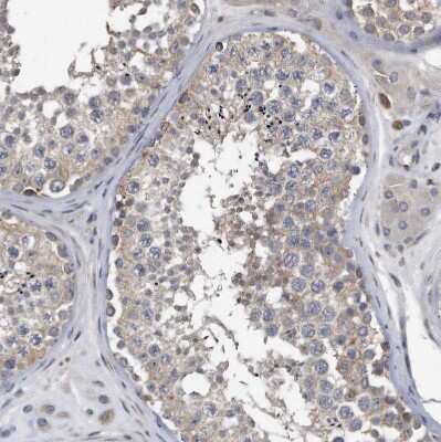 Immunohistochemistry-Paraffin: Piccolo Antibody [NBP1-90250]