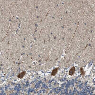 Immunohistochemistry-Paraffin: Piccolo Antibody [NBP1-90251]