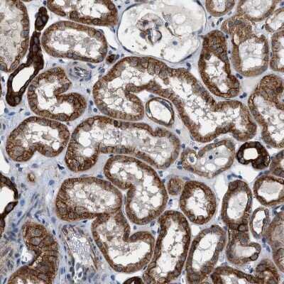 Immunohistochemistry-Paraffin: Piccolo Antibody [NBP1-90251]