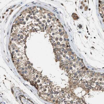 Immunohistochemistry-Paraffin: Piccolo Antibody [NBP1-90251]