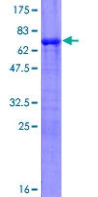 SDS-PAGE: Recombinant Human Piccolo GST (N-Term) Protein [H00027445-P01]