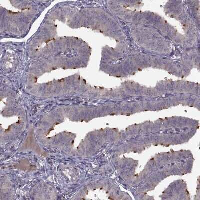 Immunohistochemistry-Paraffin: Pierce-1 Antibody [NBP1-81136]