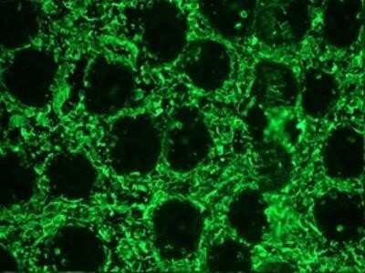 Immunocytochemistry/ Immunofluorescence: Pig anti-Mouse IgG (H+L) Secondary Antibody [NBP2-69410]