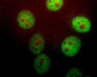 Immunocytochemistry/ Immunofluorescence: Pin1 Antibody [NBP1-05424]