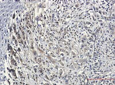 Immunohistochemistry-Paraffin: Pin1 Antibody (S01-7G8) [NBP3-15076]