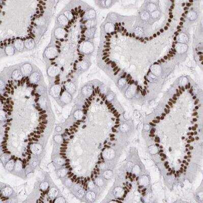 Immunohistochemistry-Paraffin: Pinin Antibody [NBP1-87784]