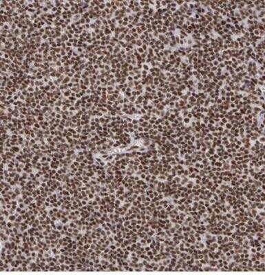 Immunohistochemistry-Paraffin: Pinin Antibody [NBP1-87784]