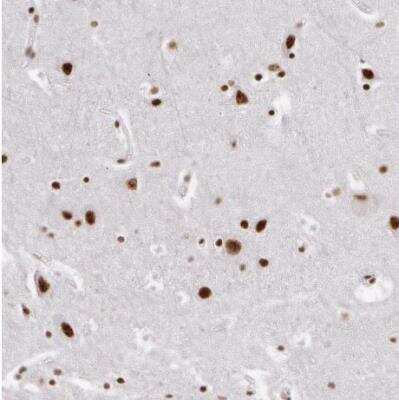 Immunohistochemistry-Paraffin: Pinin Antibody [NBP1-87784]