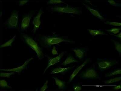 Immunocytochemistry/ Immunofluorescence: Pipecolic acid oxidase Antibody (3D1) [H00051268-M10]