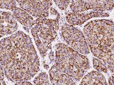 Immunohistochemistry-Paraffin: Pipecolic acid oxidase Antibody [NBP2-99598]