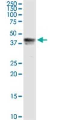 Western Blot: Pipecolic acid oxidase Antibody [H00051268-D01P]