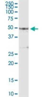 Western Blot: Pipecolic acid oxidase Antibody [H00051268-D01P]