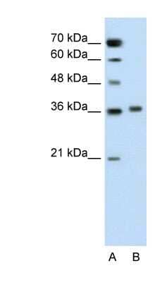 Western Blot: Pipecolic acid oxidase Antibody [NBP1-60060]