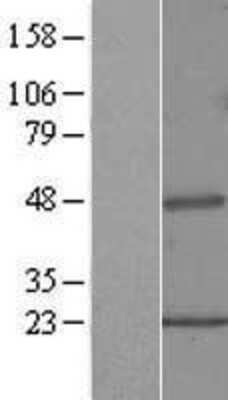 Western Blot: Pipecolic acid oxidase Overexpression Lysate [NBL1-14438]