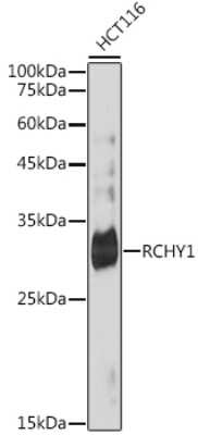 Western Blot: Pirh2 Antibody (4Q5H9) [NBP3-15743]