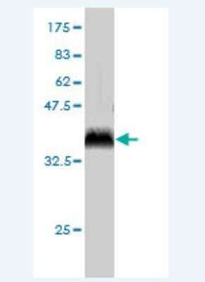 Western Blot: Pirh2 Antibody (5D12) [H00025898-M01]