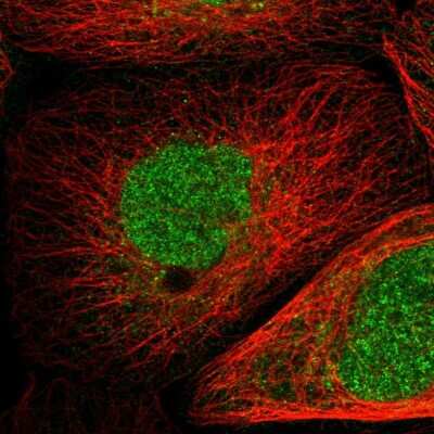 Immunocytochemistry/ Immunofluorescence: Pirh2 Antibody [NBP1-90098]